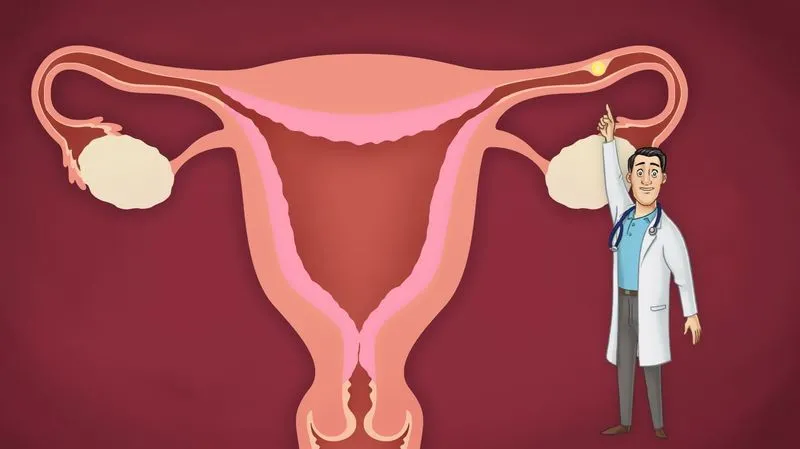 Брюшная беременность: причины, симптомы, диагностика, лечение и возможные последствия. Внематочная беременность поздних сроков Случаи доношенной брюшной беременности