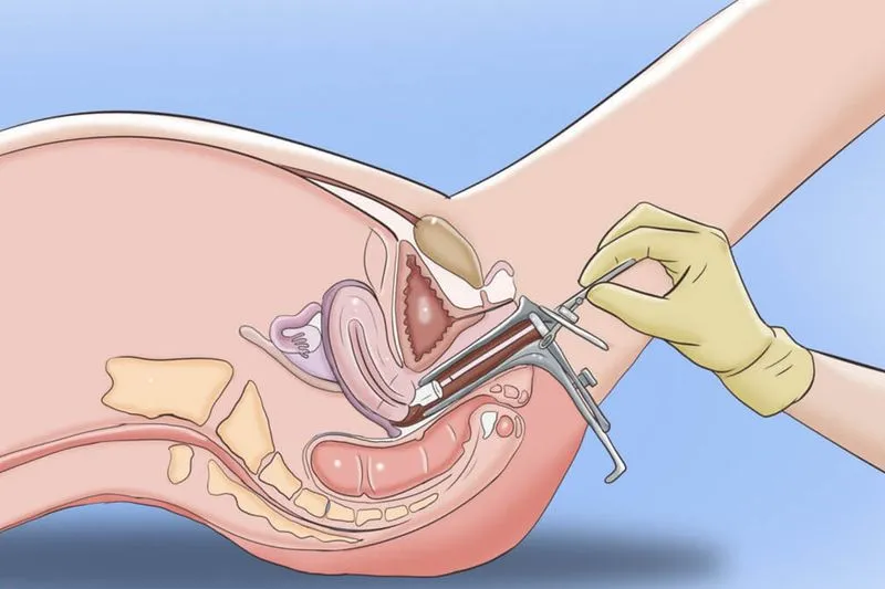 Как гинеколог определяет беременность на раннем сроке? Как гинеколог понимает что наступила беременность